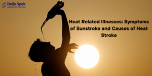 Symptoms of Sunstroke and Causes of Heat Stroke